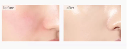 ROSE PETAL SERUM - RESERVE EDITION – FOR GLOWING SKIN - COLLAGEN BOOST, STRESS REDUCTION & VITAMIN C BRIGHTENING