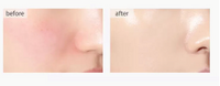 ROSE PETAL SERUM - RESERVE EDITION – FOR GLOWING SKIN - COLLAGEN BOOST, STRESS REDUCTION & VITAMIN C BRIGHTENING